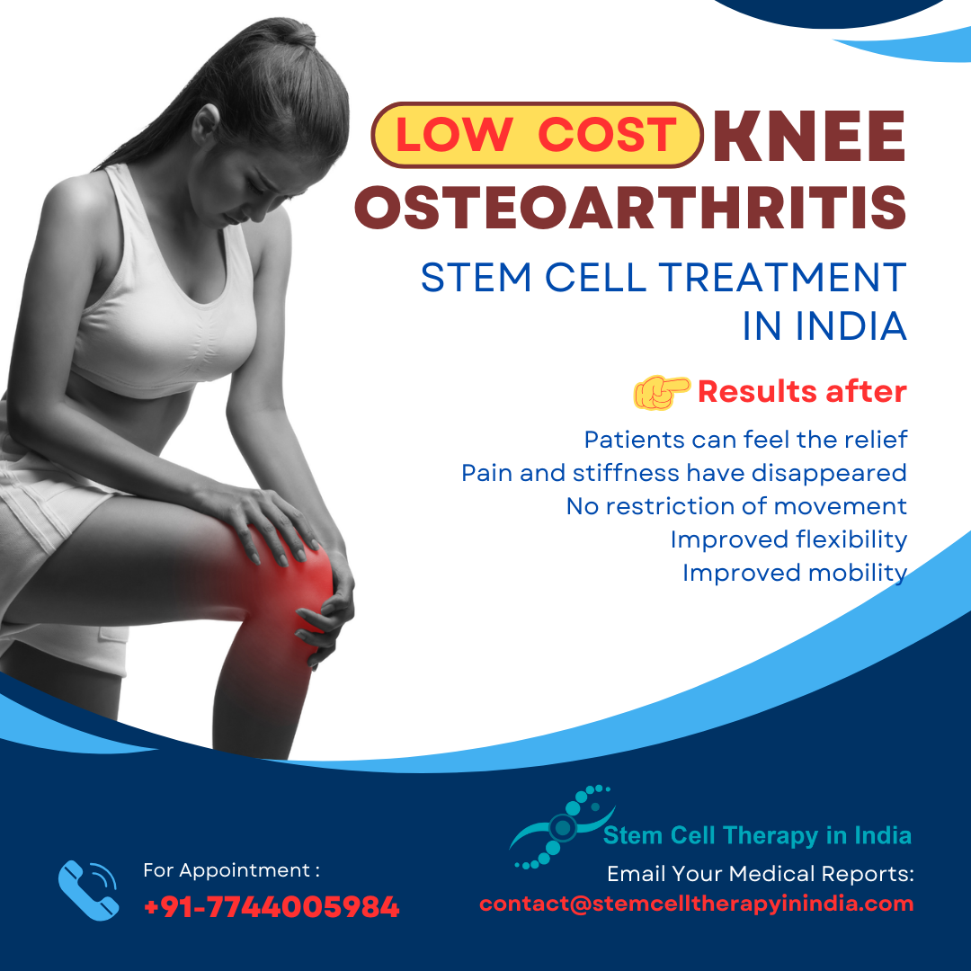 Knee Osteoarthritis Stem Cell Treatment In India