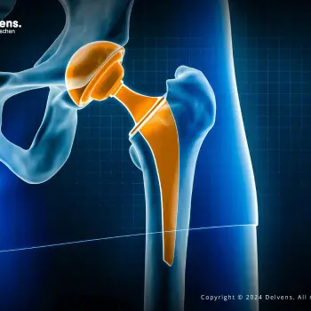 _Knee and Hip Replacement  (1)