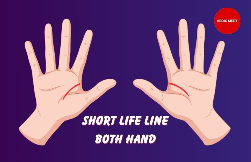 Short Life Line Both Hand
