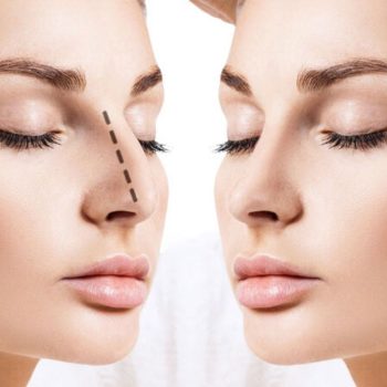 Transform Yourself With Nose Surgery Rhinoplasty And Improve looksUntitled design (1)