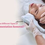 What are the Different Types of Lasers for Pigmentation Removal