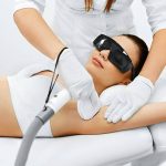 laser hair removal (4)
