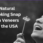 natural looking snap on veneers