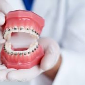 Best orthodontists in Bangalore... (1)