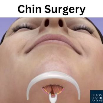 Chin Surgery