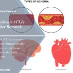 Critical Limb Ischemia (CLI) Treatment Market New