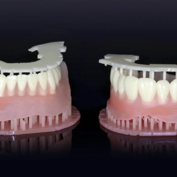 Dental 3D Printing Market
