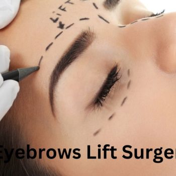 Eyebrows Lift Surgery