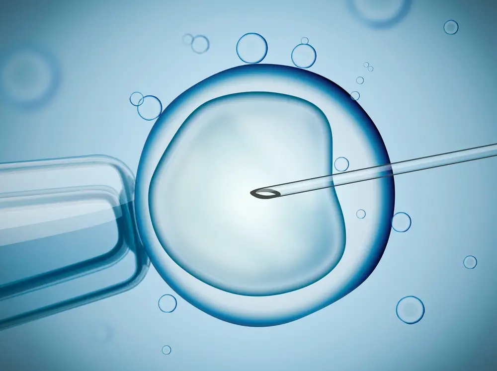 IVF-Treatment