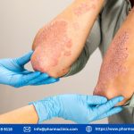 Understanding Dark Skin from Eczema: A Comprehensive Guide