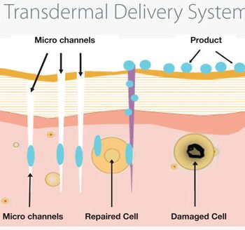 transdermal-delivery-system