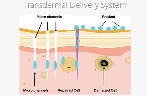 transdermal-delivery-system