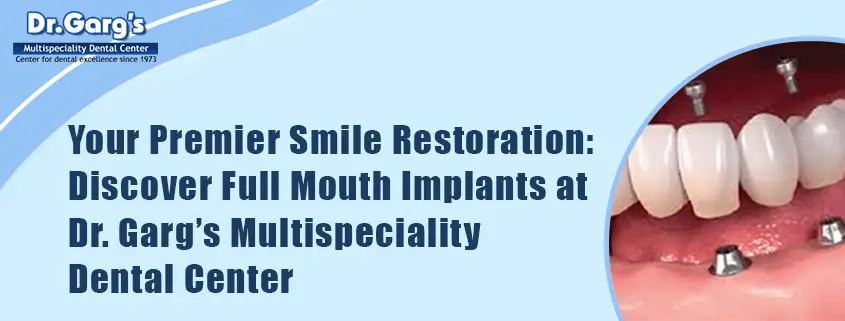 your-premier-smile-restoration-discover-full-mouth-implants-at-dr-Garg’s Multispeciality Dental Center