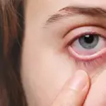 Dry-Eye-Syndrome_-Causes-Symptoms-and-Relief-Options
