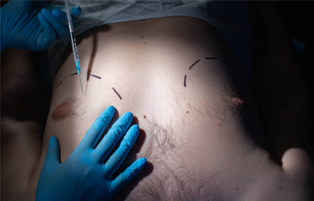 Inverted nipple surgery in riyadh (11)