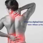 What is a Spinal Cord Stimulator and How it Works in Pain Management