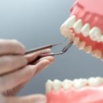 Tooth Replacement Market