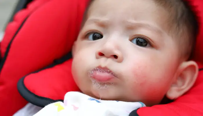 Comparing drool rash and eczema1