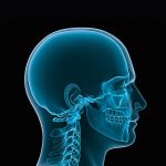 Craniomaxillofacial (CMF) Devices Market 1