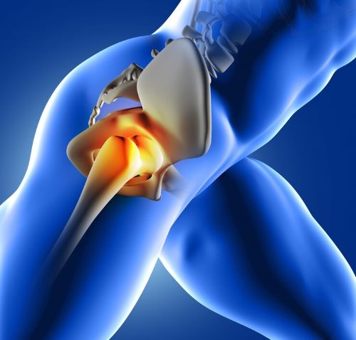 Hip Replacement Market Report