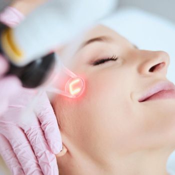 Pico Laser Treatment