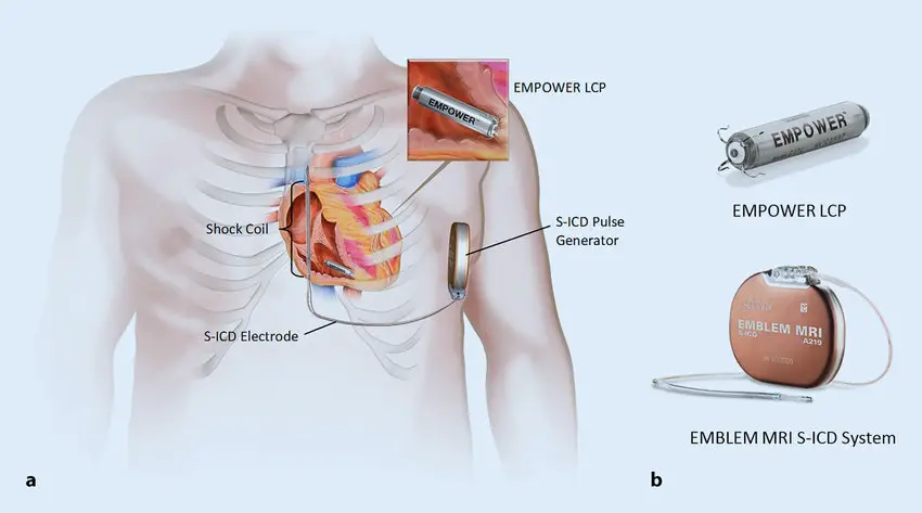 Cardiac Rhythm Management Devices Market Overview: Size, Share and Trend Analysis