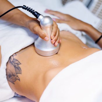 Cavitation_laser-lipo