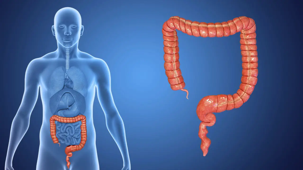 Colorectal Procedure