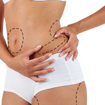 Cost-of-Liposuction-in-UAE