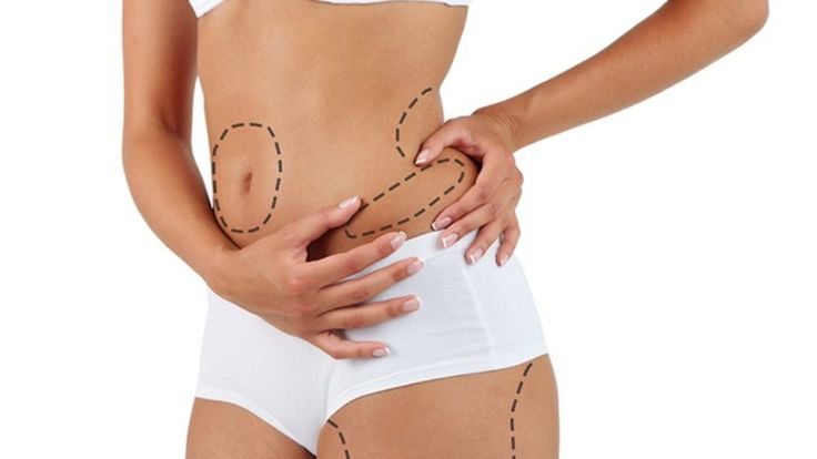 Cost-of-Liposuction-in-UAE