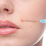 Glutathione Injections in Dubai