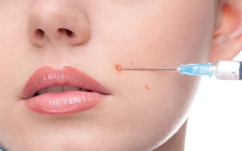 Glutathione Injections in Dubai