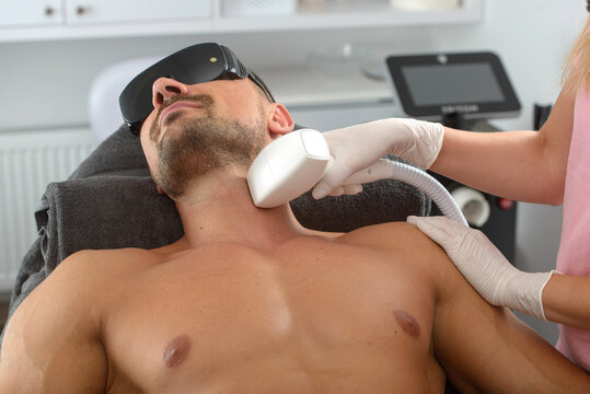 Laser Hair Removal men 7