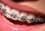 best orthodontist in ahmedabad