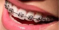 best orthodontist in ahmedabad
