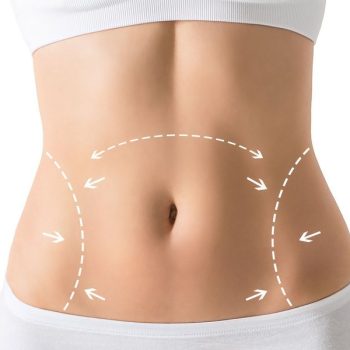 Circumferential Abdominoplasty in Dubai uae