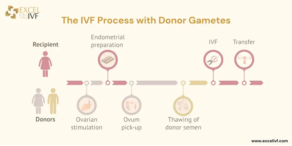 IVF with Donor Egg and Sperm- A Hopeful Path to Parenthood