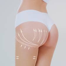 Non Surgical Bum Lift in Dubai