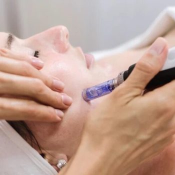 Skin needling and microdermabrasion__630x480-1 (1)