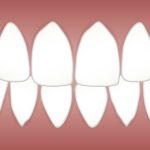 dental-3599752__340