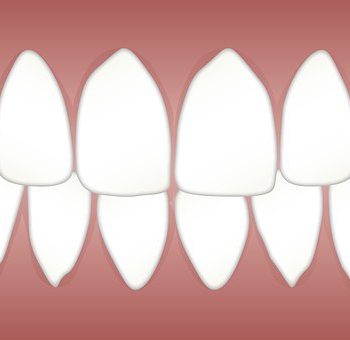 dental-3599752__340